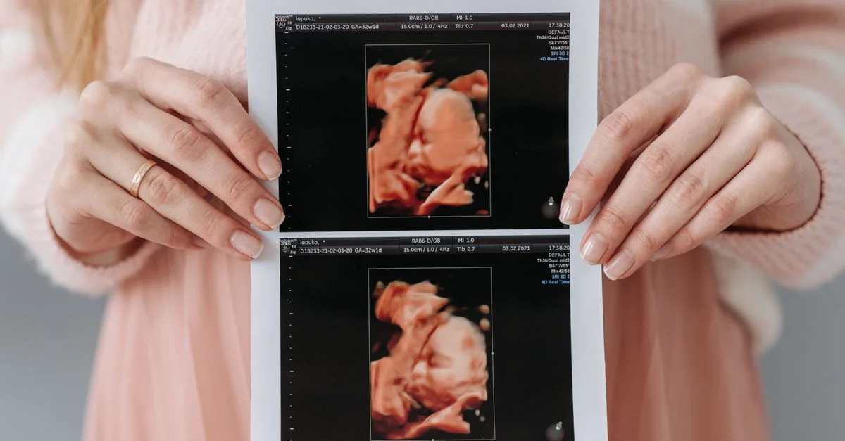 Close-up de una mujer embarazada sosteniendo una impresión de ultrasonido, simbolizando anticipación y cuidado materno.